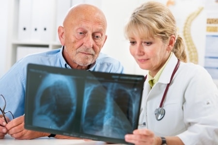 A doctor showing a scan to an elderly man