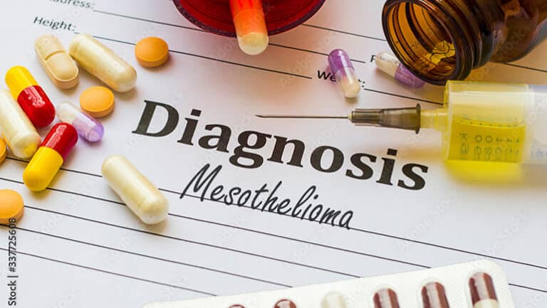 Mesothelioma Diagnosis Documents and some healthcare items