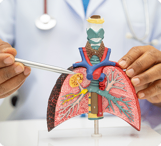 Pneumonia, lung cancer, Asian doctor holding human anatomy model for study diagnosis