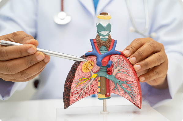 Pneumonia, lung cancer, Asian doctor holding human anatomy model for study diagnosis